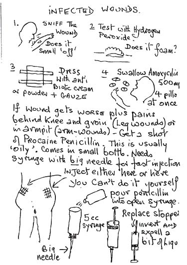 BrokenGuts-Small_Page_073